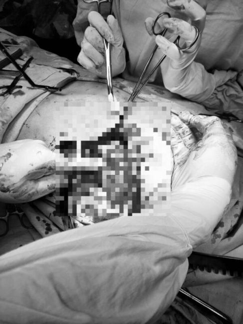 Мужчину с ножевым ранением в сердце спасли подмосковные врачи

В..